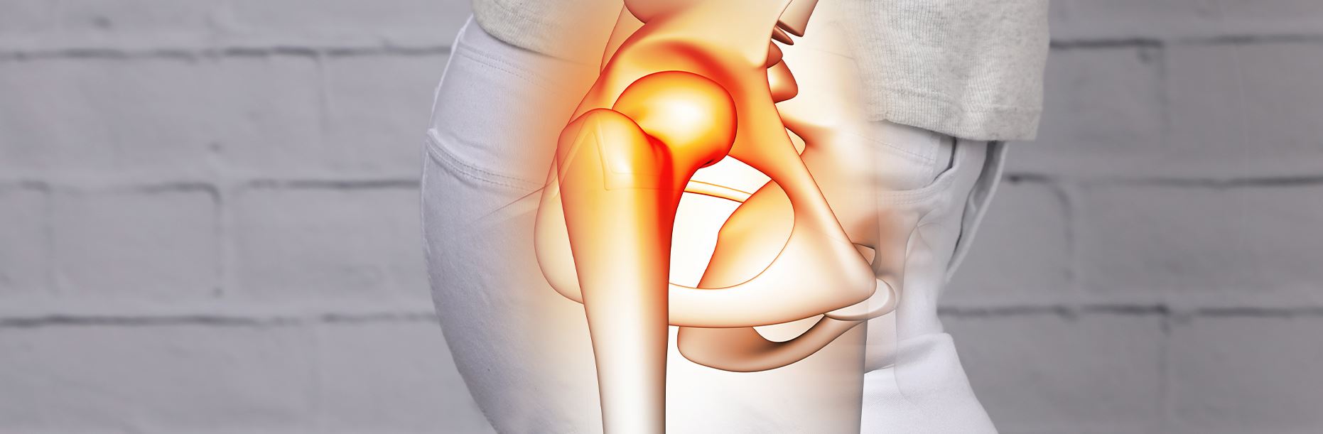 Hip Bursitis Video, Hip Orthopaedics Videos